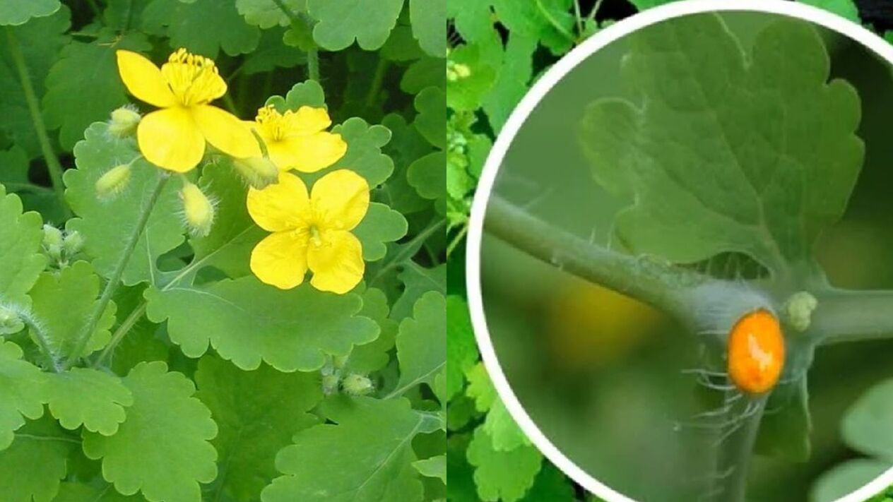 celandina împotriva verucilor