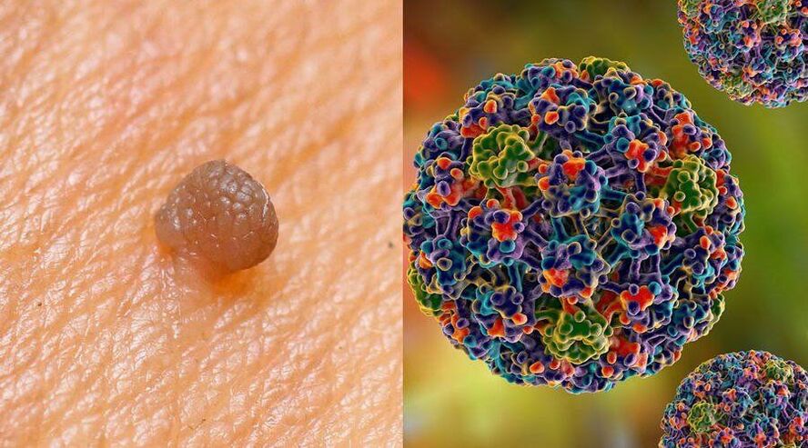 Căile de transmitere a HPV