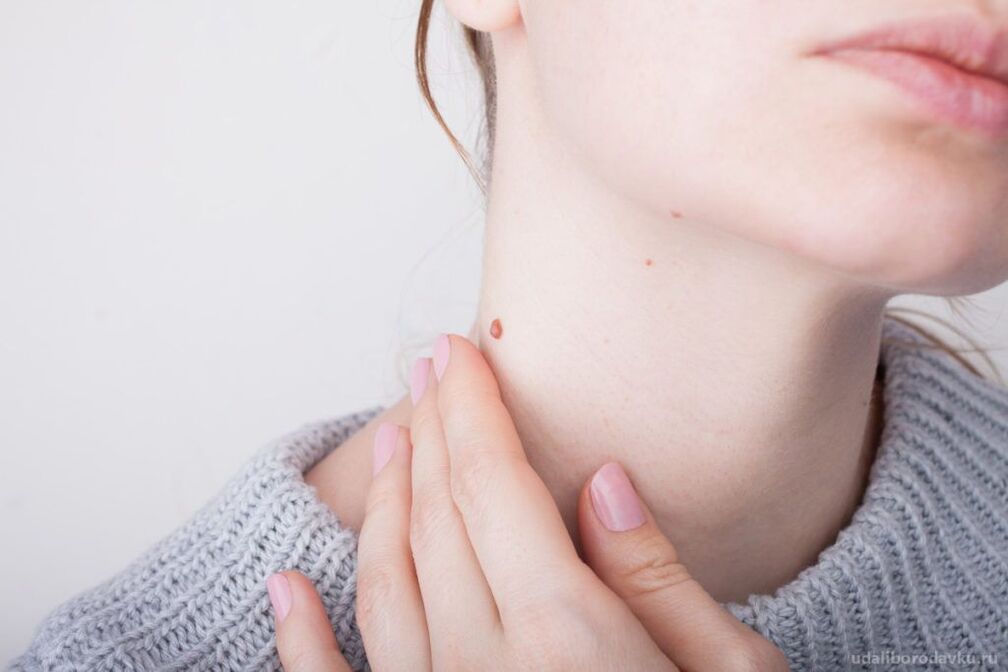 Patogeneza HPV